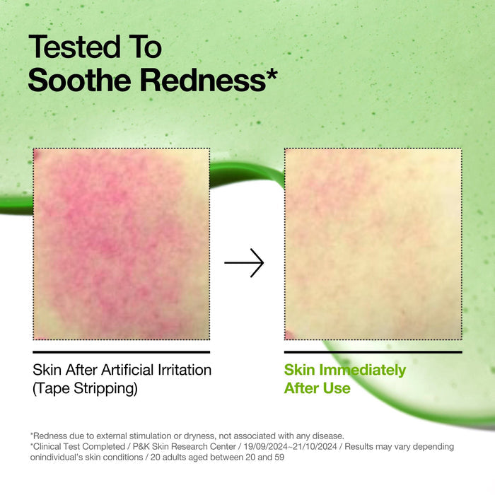 Azelaic Acid 10% + Hyaluron Serum –Anua