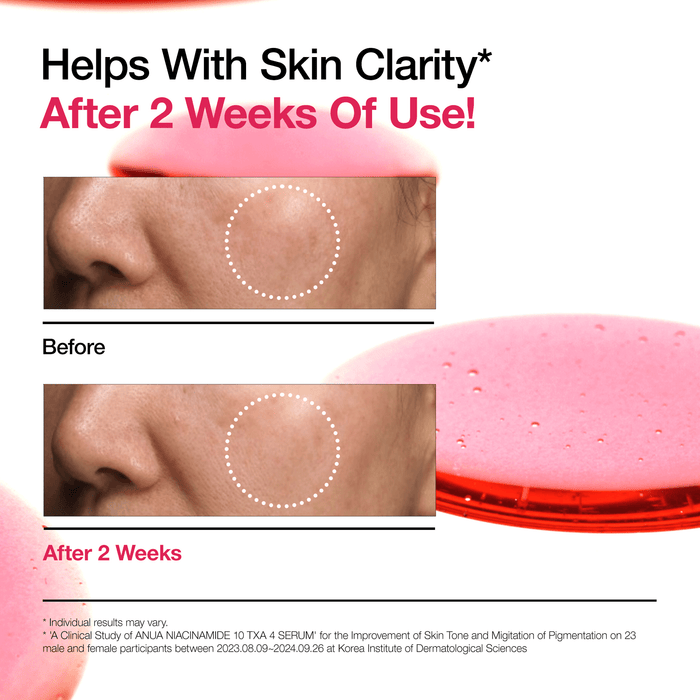 Niacinamide 10% + TXA 4% Serum –Anua